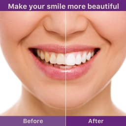 image-Teeth Cleaning Mousse Anti-moth Cleaning Yellow Teeth Tartar Breath Fresh Brightening White Beautiful Tooth Toothpaste