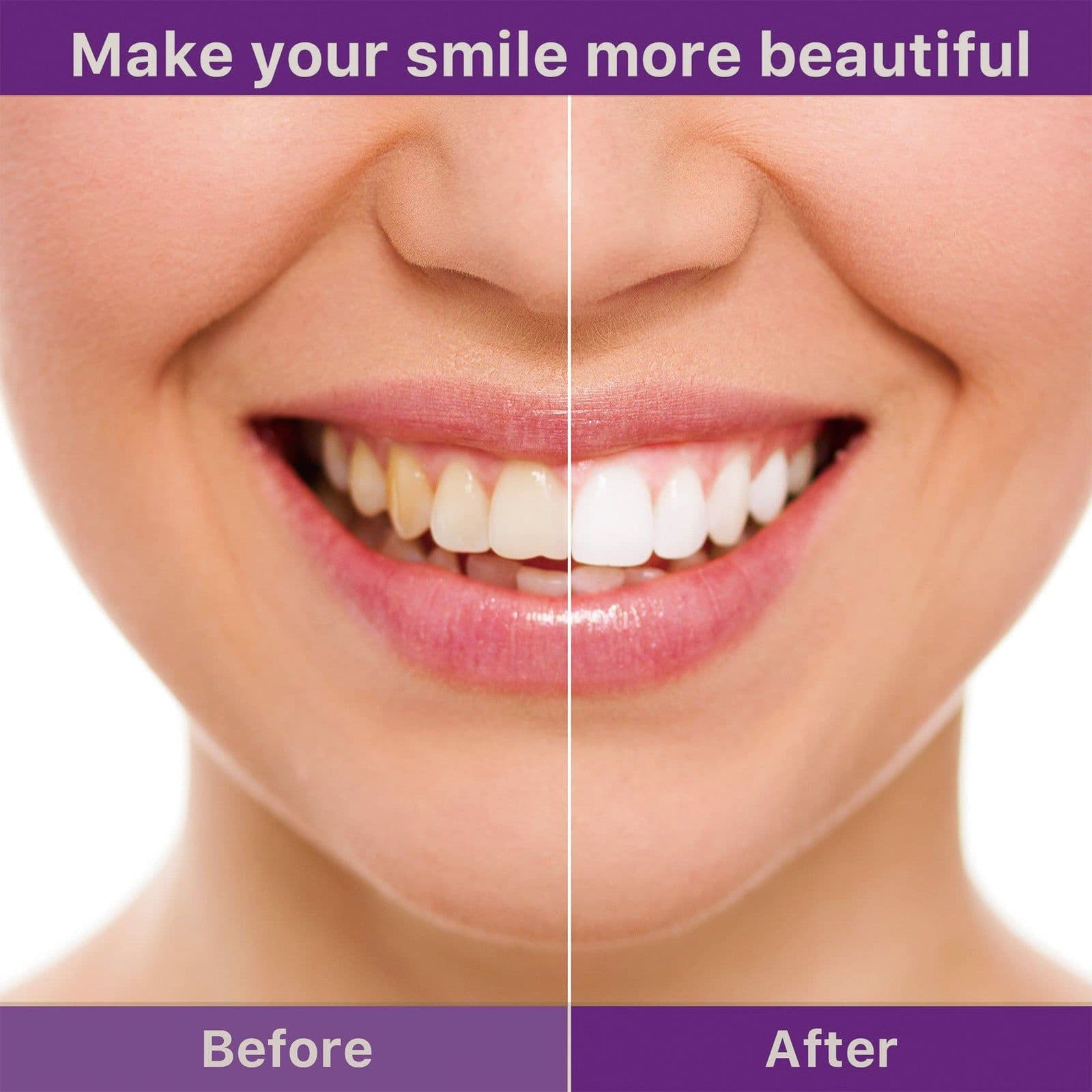 image-Teeth Cleaning Mousse Anti-moth Cleaning Yellow Teeth Tartar Breath Fresh Brightening White Beautiful Tooth Toothpaste