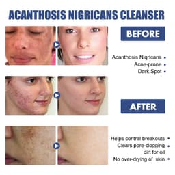 image-Cleaning Softening Skin Repair Facial Cleanser