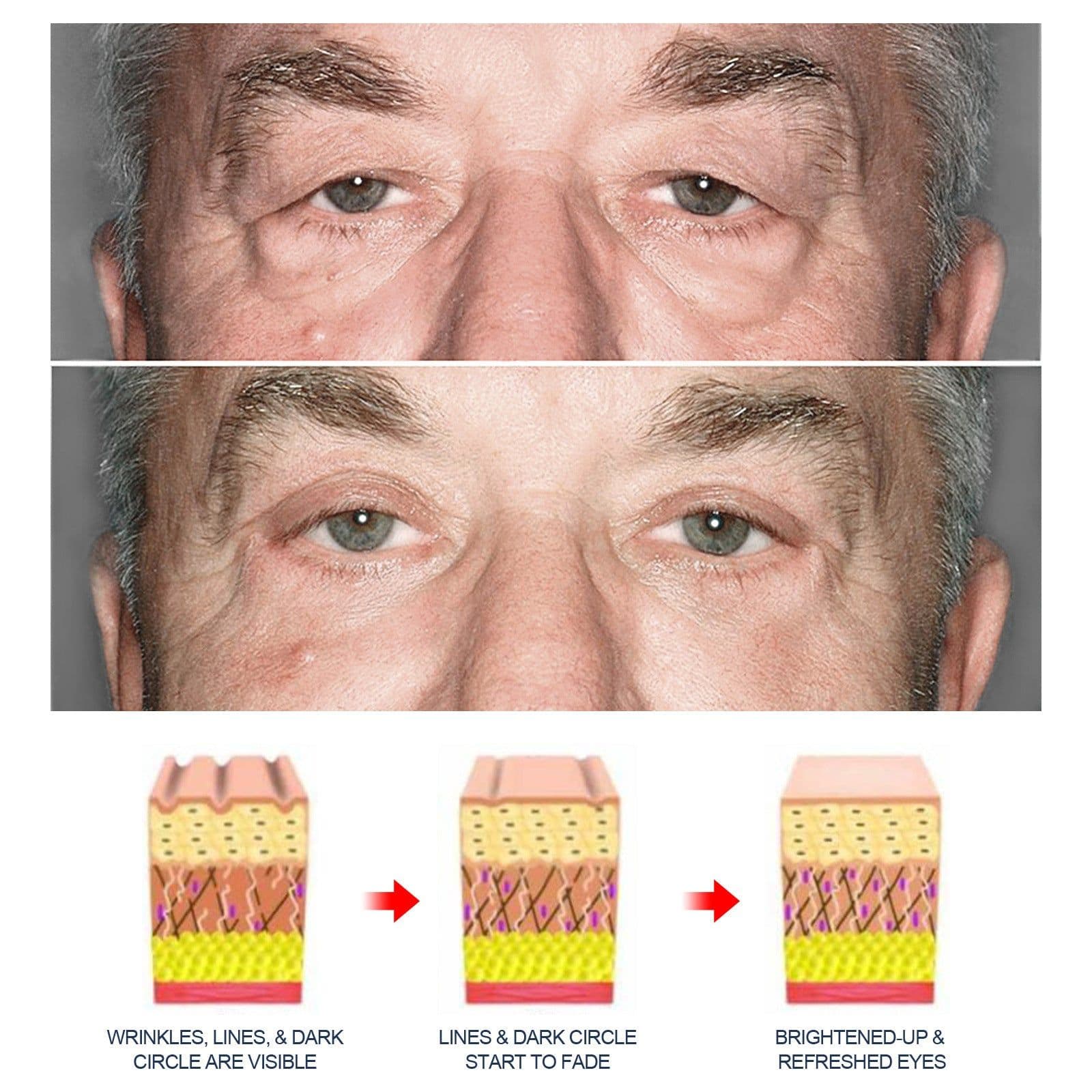 image-Men's Anti-aging Eye Cream