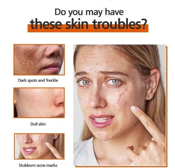 image-Kojic Acid Soap Skin Cleaning Facial Soap