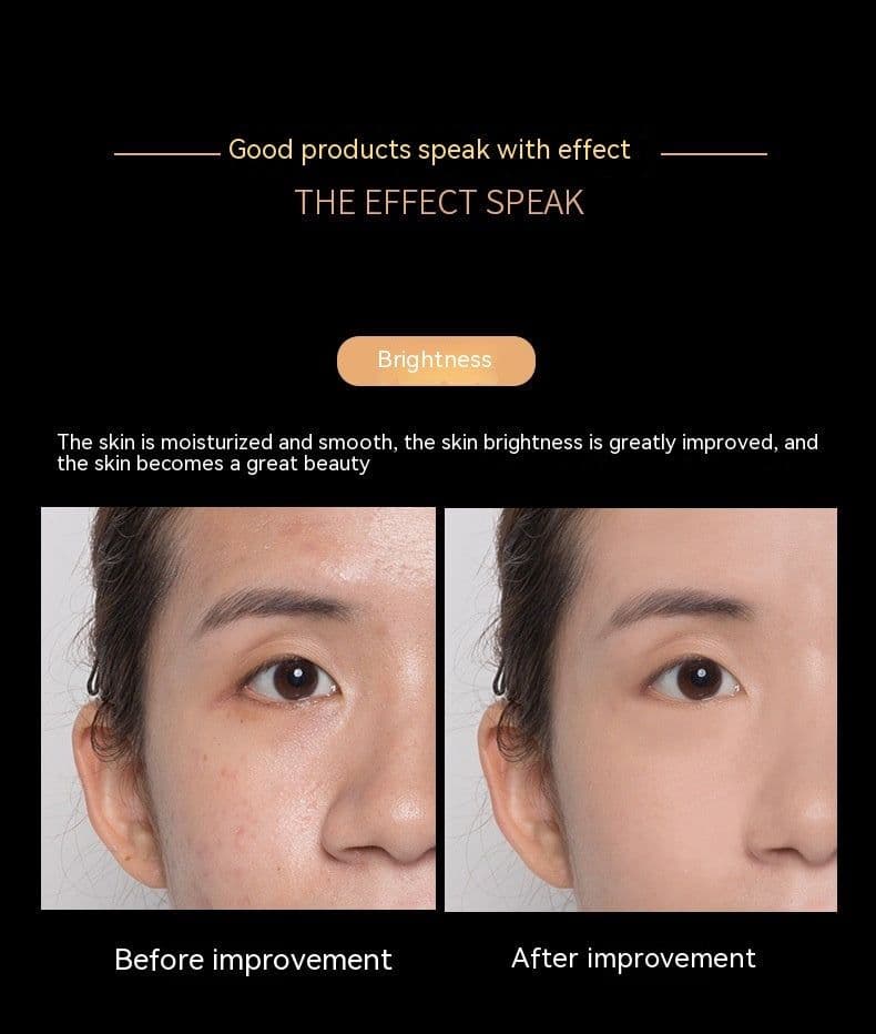 image-Skin Care 5-piece Set Day And Night Cream Brightening Skin Color Repair Fading Wrinkle Moisturizing Kit