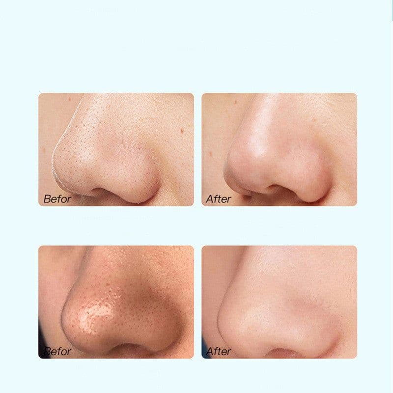 image-Pore Cleanser Beauty Salon Special Blackhead Removal Whitehead Acne Deep Pore Cleaning Fluid