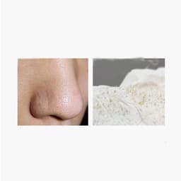 image-Pore Cleanser Beauty Salon Special Blackhead Removal Whitehead Acne Deep Pore Cleaning Fluid