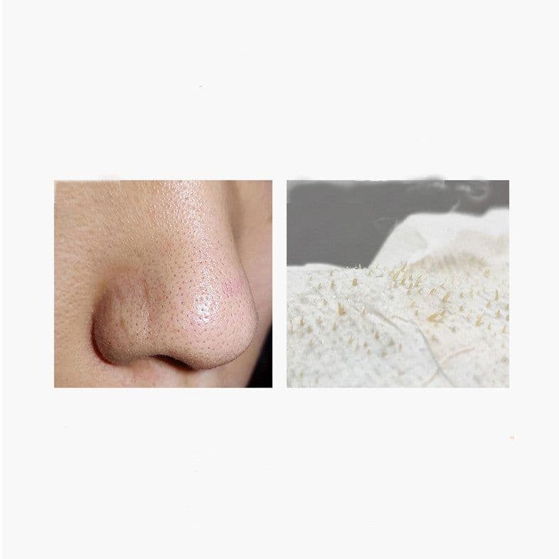 image-Pore Cleanser Beauty Salon Special Blackhead Removal Whitehead Acne Deep Pore Cleaning Fluid