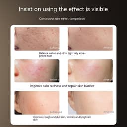 image-Photon IPL Device Beauty Mask LED Home Phototherapy Beauty Instrument