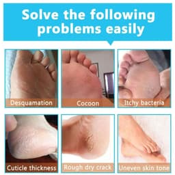 image-Exfoliating Hydrating Repair Tender And Smooth Hand And Foot Membrane