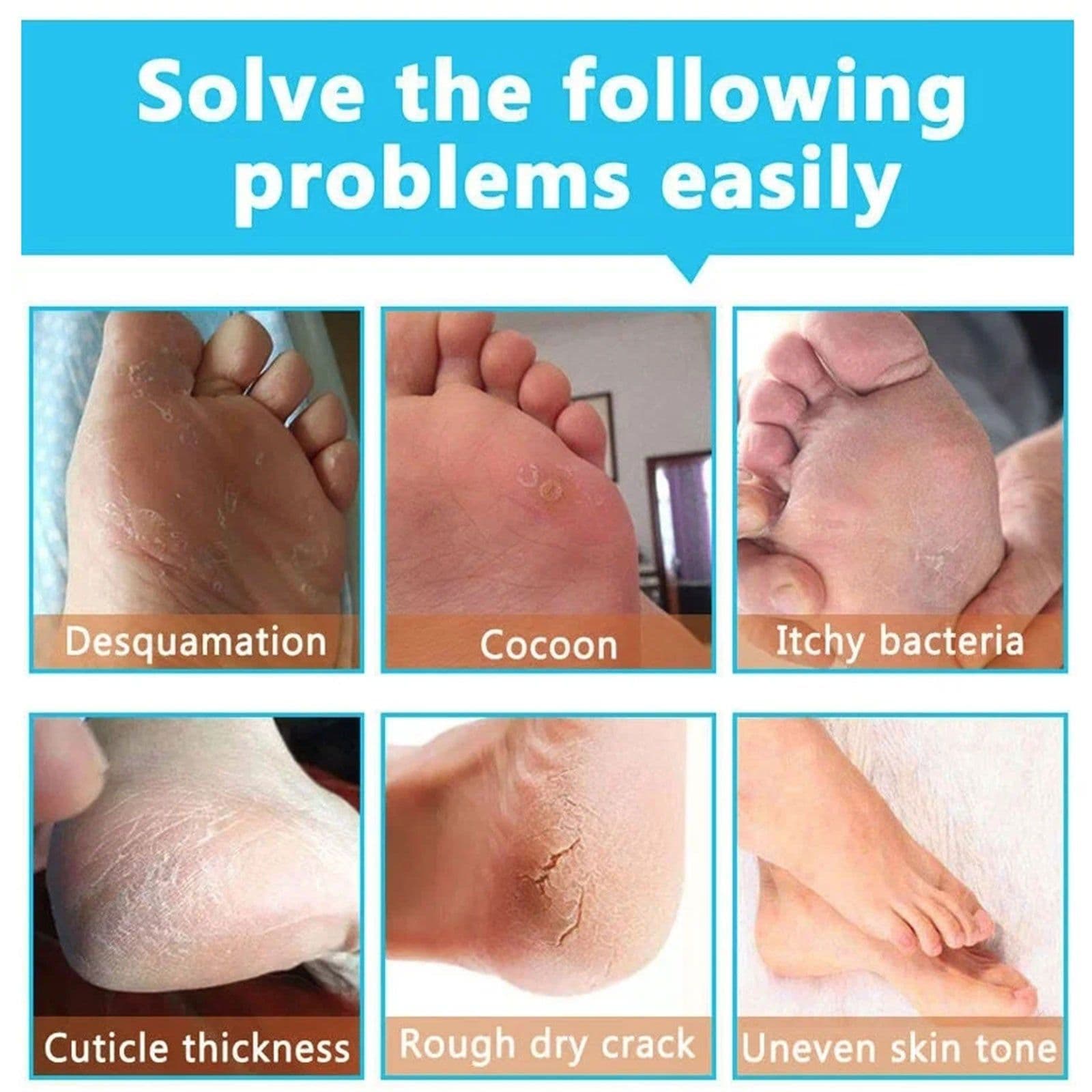 image-Exfoliating Hydrating Repair Tender And Smooth Hand And Foot Membrane