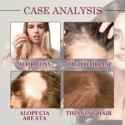 image-Onion Hair Essential Oil Spray