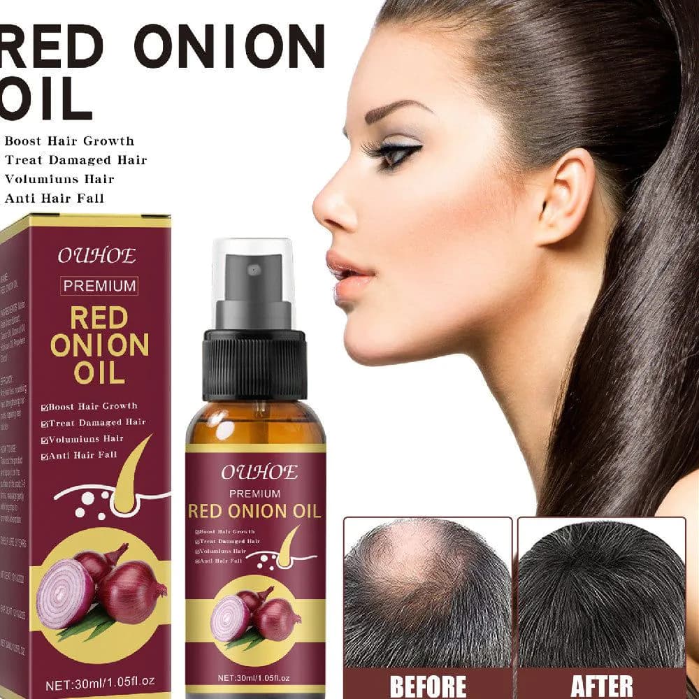 image-Onion Hair Essential Oil Spray