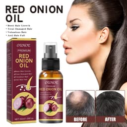 image-Onion Hair Essential Oil Spray