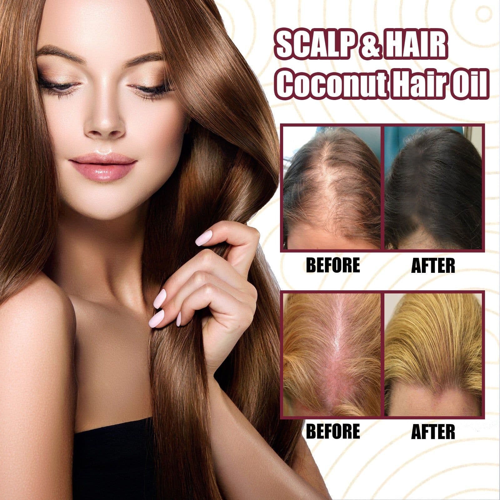 image-Onion Hair Essential Oil Spray