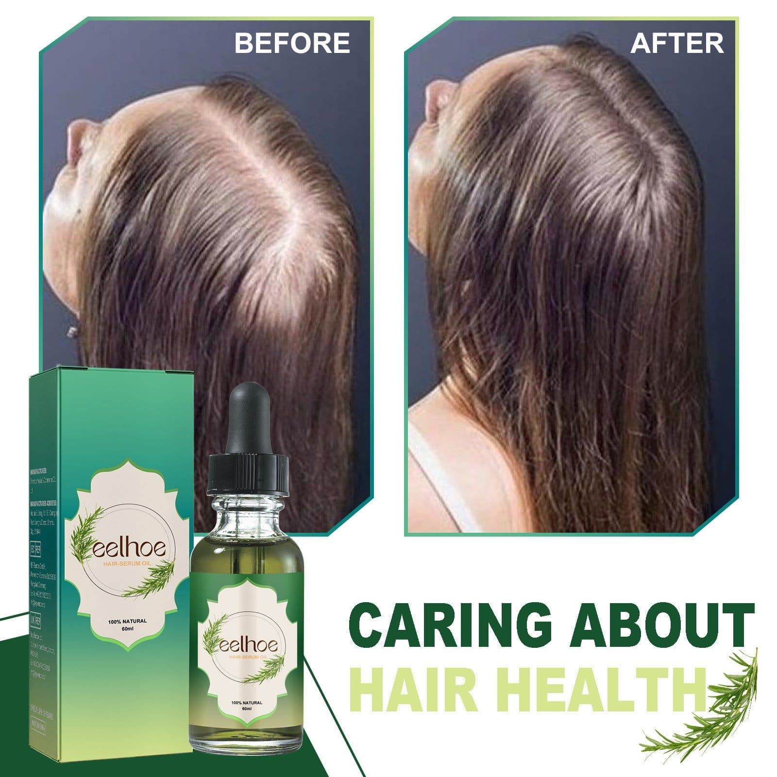 image-Nourishing Anti-hair Loss Thick Hair Care