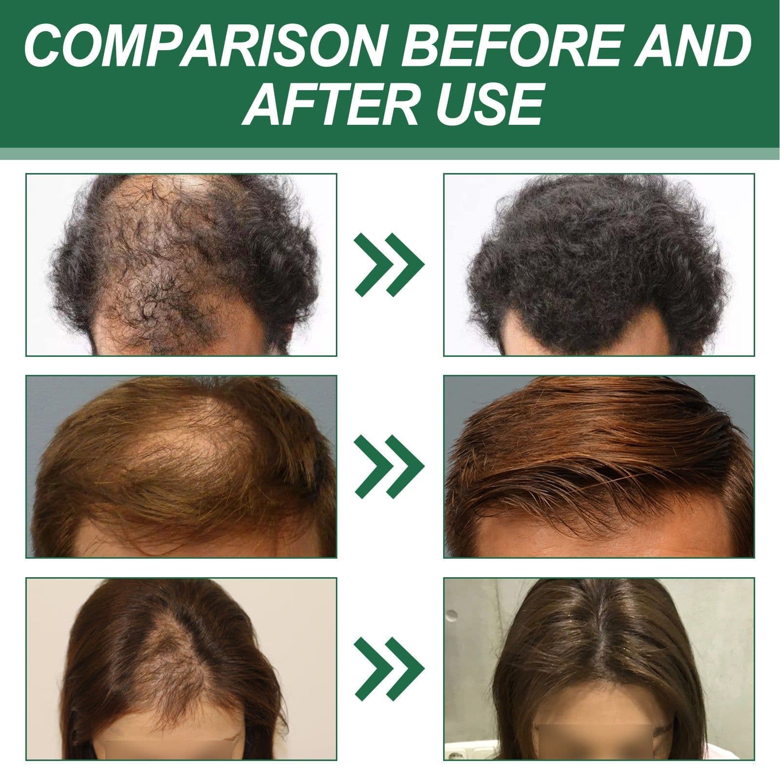 image-Anti-hair Fixing And Tough Massage Hair Care Spray