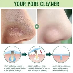image-Original Facial Remove Blackhead Green Tea Solid Mask Treat Acne Blemish Black Dots Clean Stick Cream Shrink Pores Skin Care