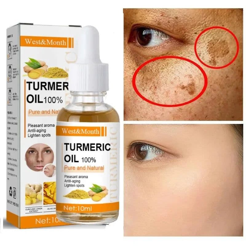image-Remove Dark Spots Turmeric Essential Oil Anti Wrinkle Face Serum Therapeutic Acne Shrink Pores Whitening Moisturizing Skin Care