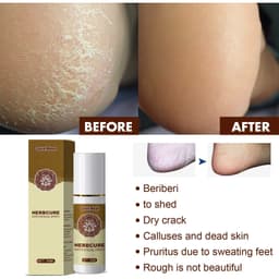 image-Herbal foot spray foot sweat foot odor care spray foot deodorant dehumidification spray plant anti-itch athlete's foot spray