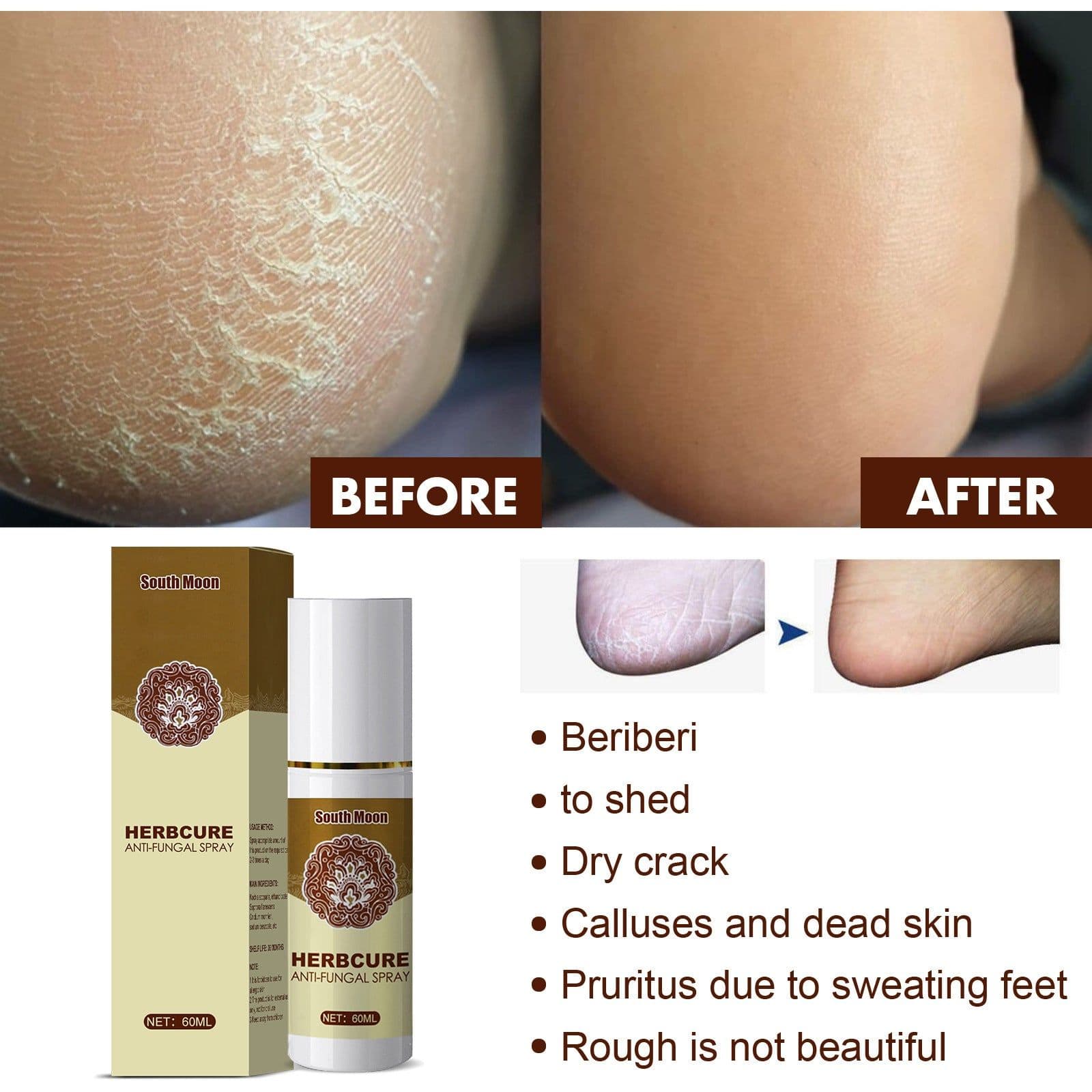 image-Herbal foot spray foot sweat foot odor care spray foot deodorant dehumidification spray plant anti-itch athlete's foot spray