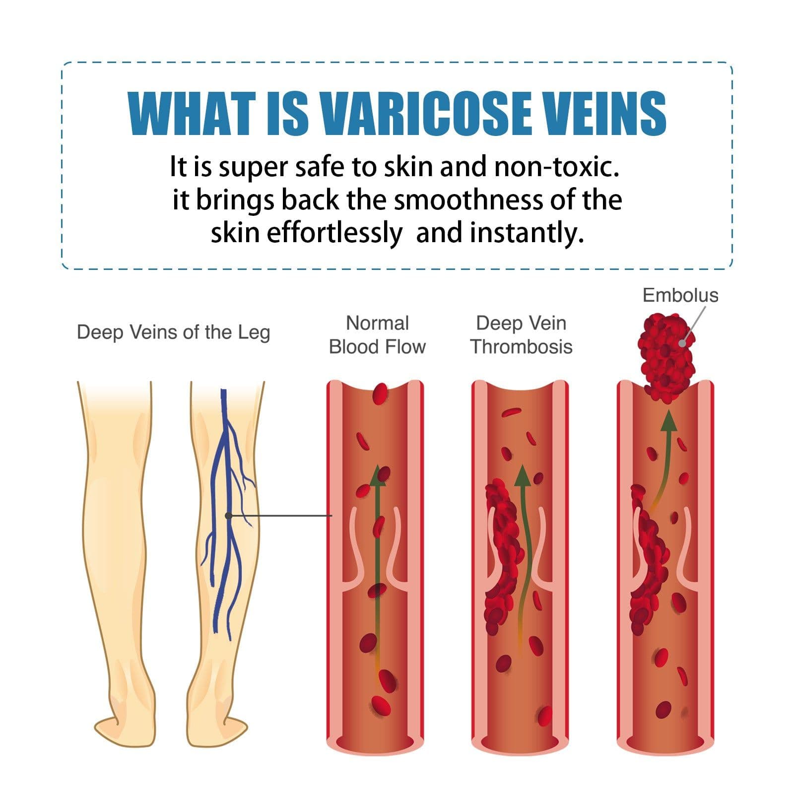 image-OUHOE Vein Repair Cream