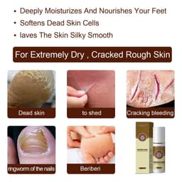 image-Herbal foot spray foot sweat foot odor care spray foot deodorant dehumidification spray plant anti-itch athlete's foot spray