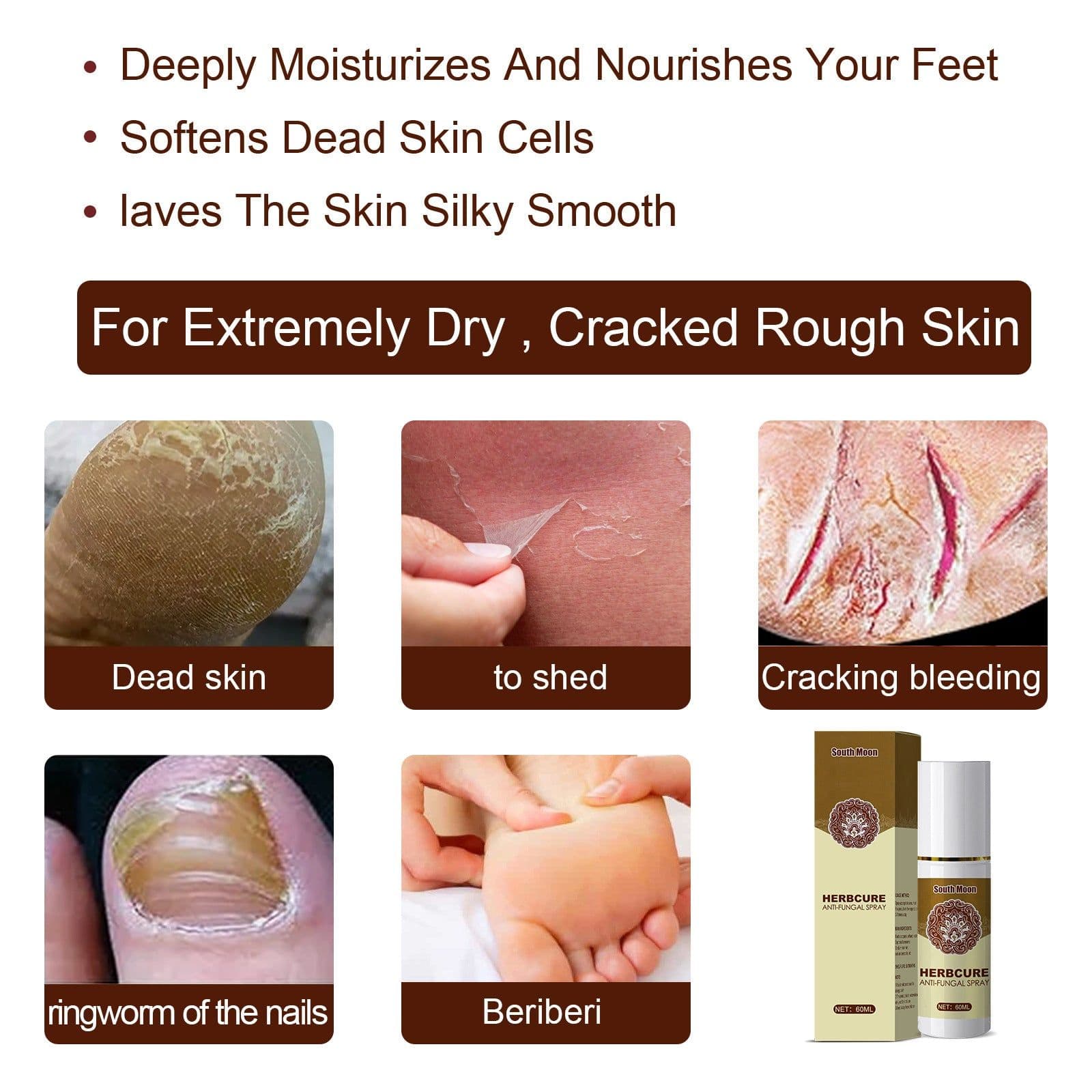 image-Herbal foot spray foot sweat foot odor care spray foot deodorant dehumidification spray plant anti-itch athlete's foot spray