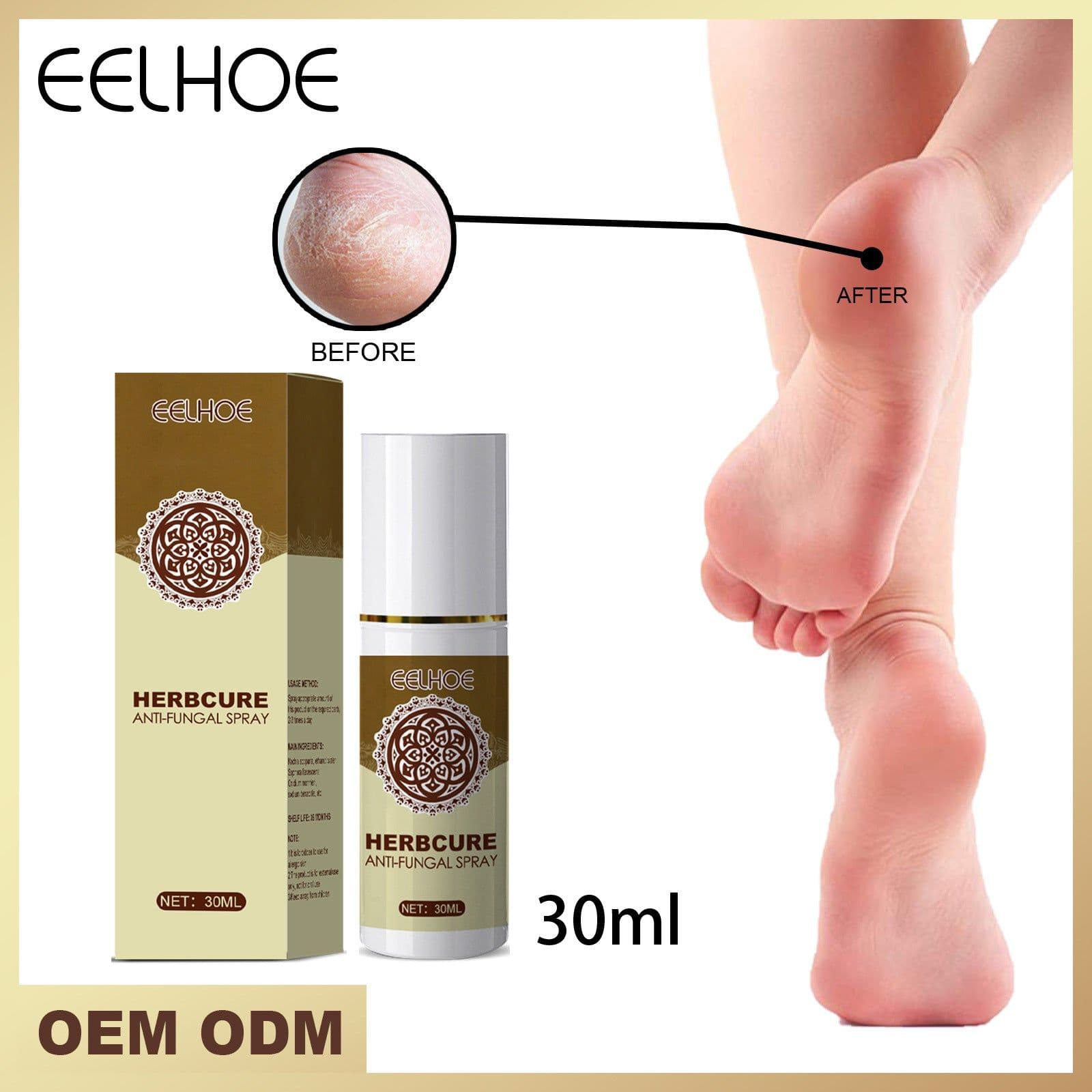 image-EELHOE Foot Spray Anti-Itch 30ml
