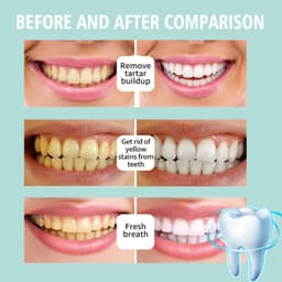 image-Jaysuing Foaming Teeth Cleansing Mousse - Deep Clean