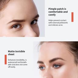 image-Acne Sticker Pimple Patch 72 Count - Invisible Concealer