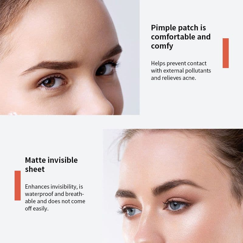 image-Acne Sticker Pimple Patch 72 Count - Invisible Concealer