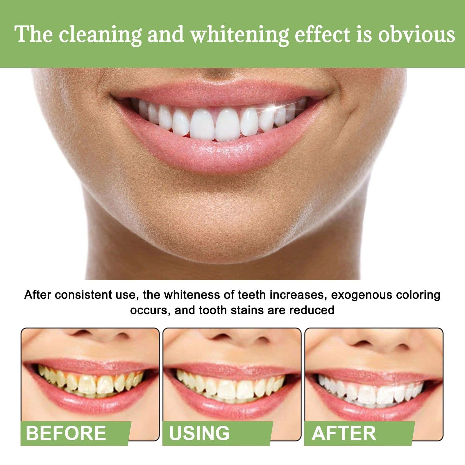 image-EELHOE Teeth Whitening Essence 1.5ml x10