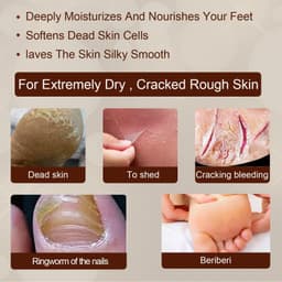 image-EELHOE Foot Spray Anti-Itch 30ml