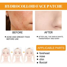image-EELHOE Hydrogel Acne Patches - Transparent 24pc