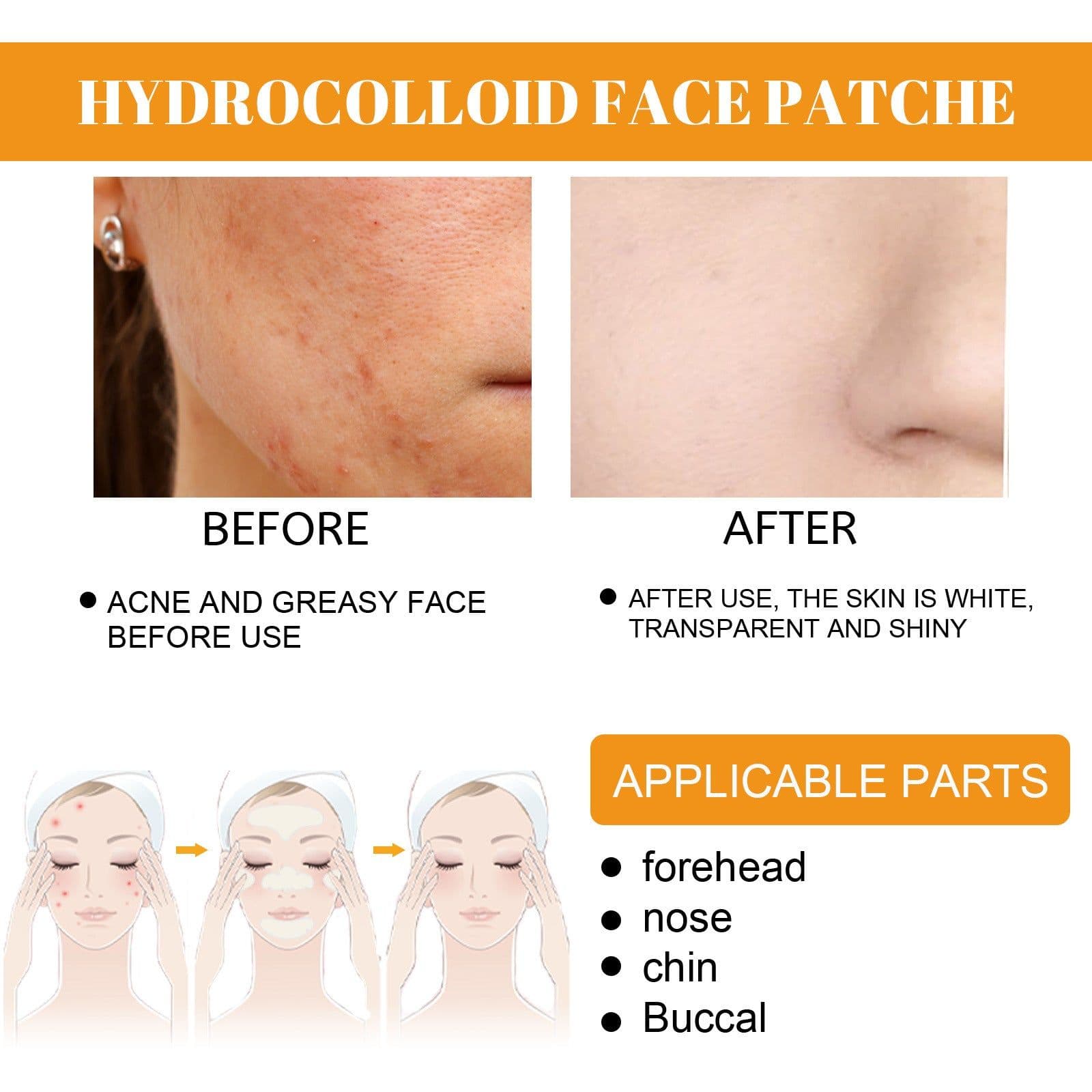 image-EELHOE Hydrogel Acne Patches - Transparent 24pc