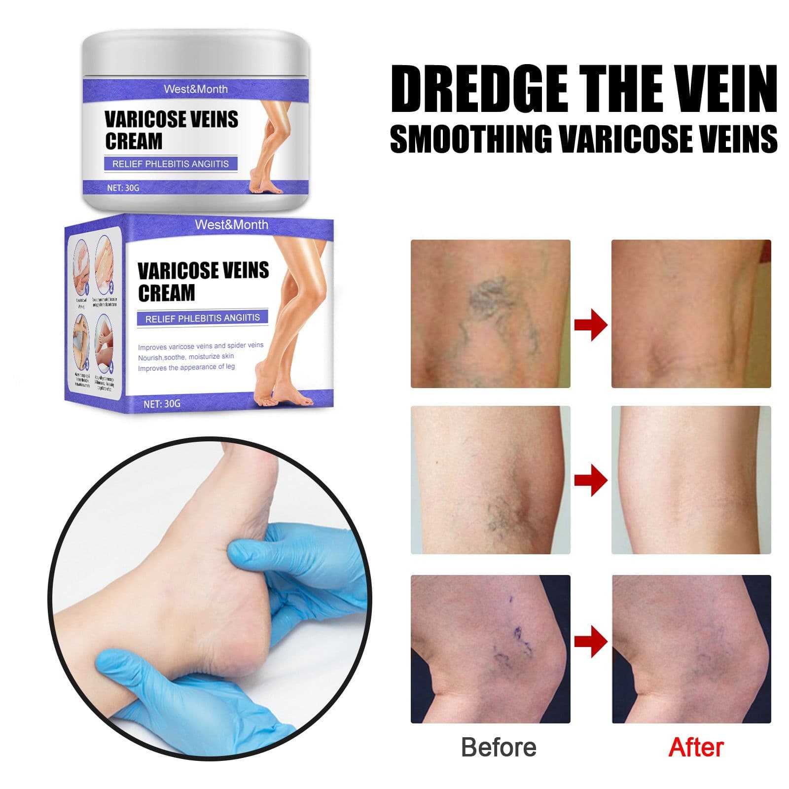 image-West&Month Vein Cream 30g Leg Pain Relief