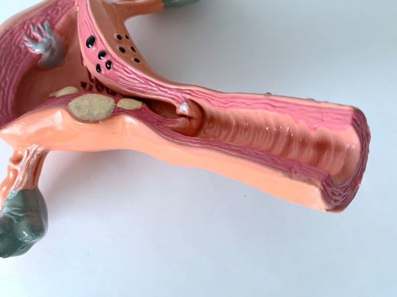image-Female Reproductive Mold Teaching Aid - Plastic - 16.5*14*17