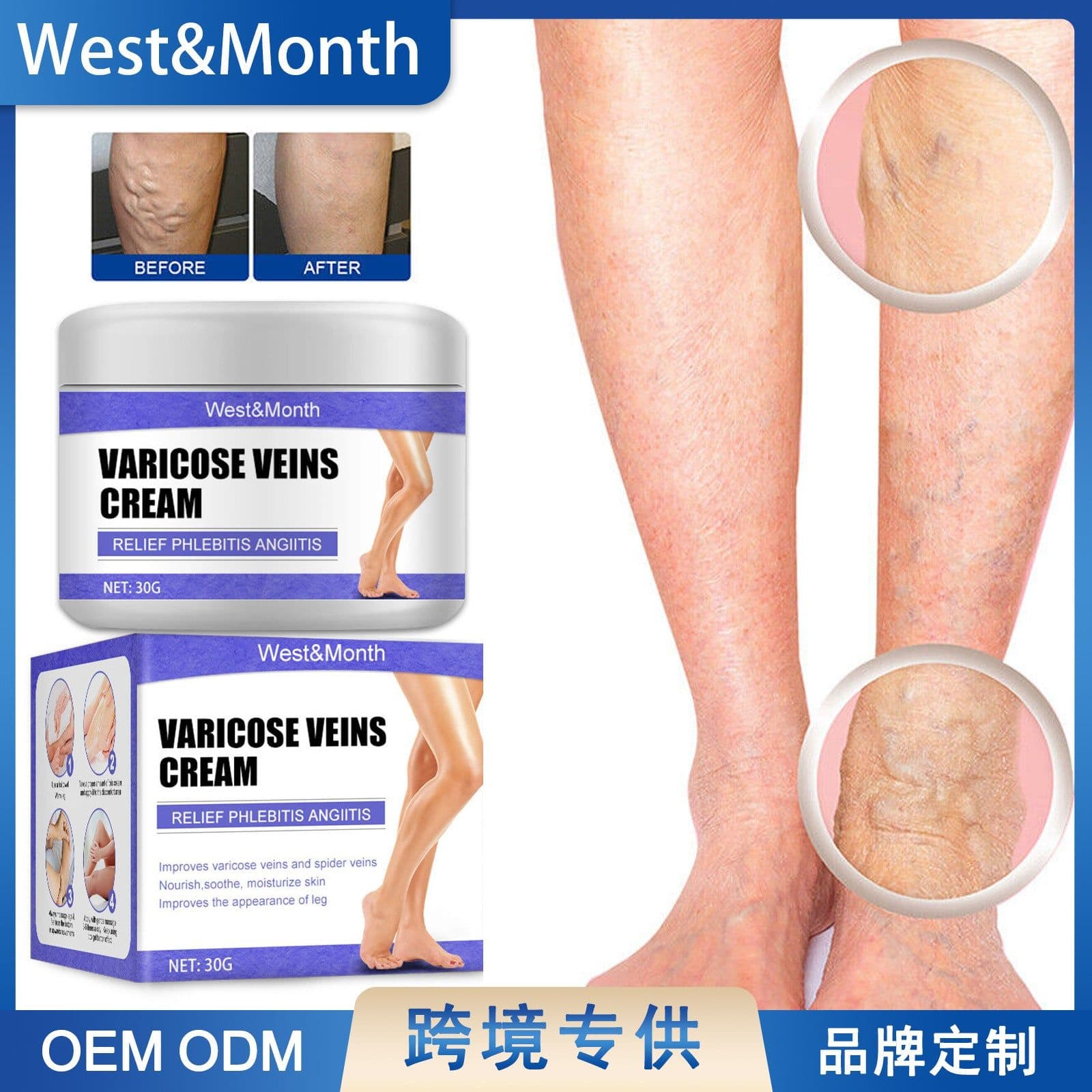 image-West&Month Vein Cream 30g Leg Pain Relief