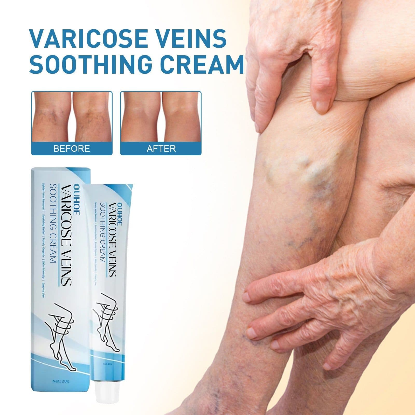image-OUHOE vein repair cream relieve leg pain massage leg sore varicose pulse health care cream