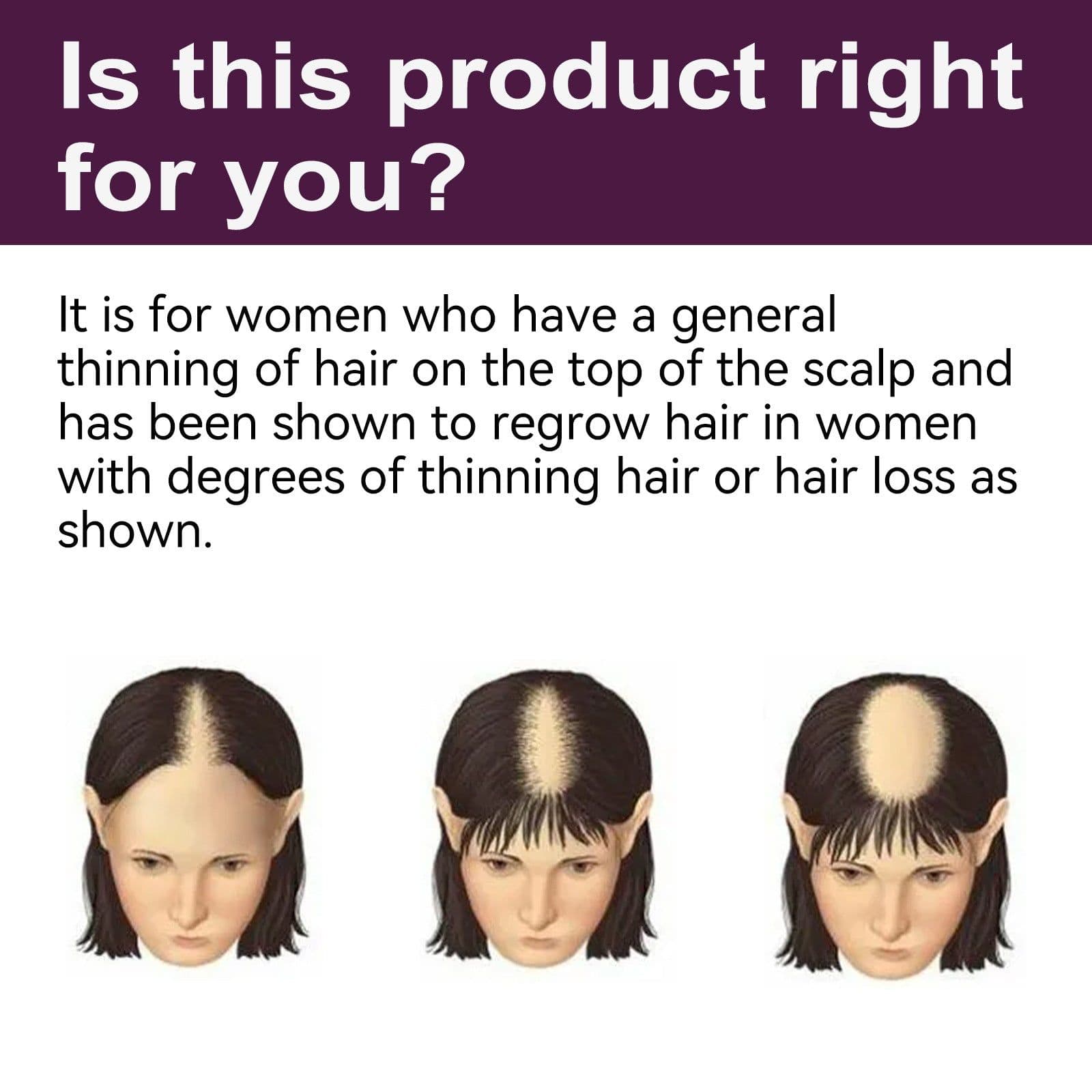 image-EELHOE Hair Growth Foam - Dense Hair Care