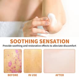 image-WIYUN Bee Venom Psoriasis Cream - Moisturizing