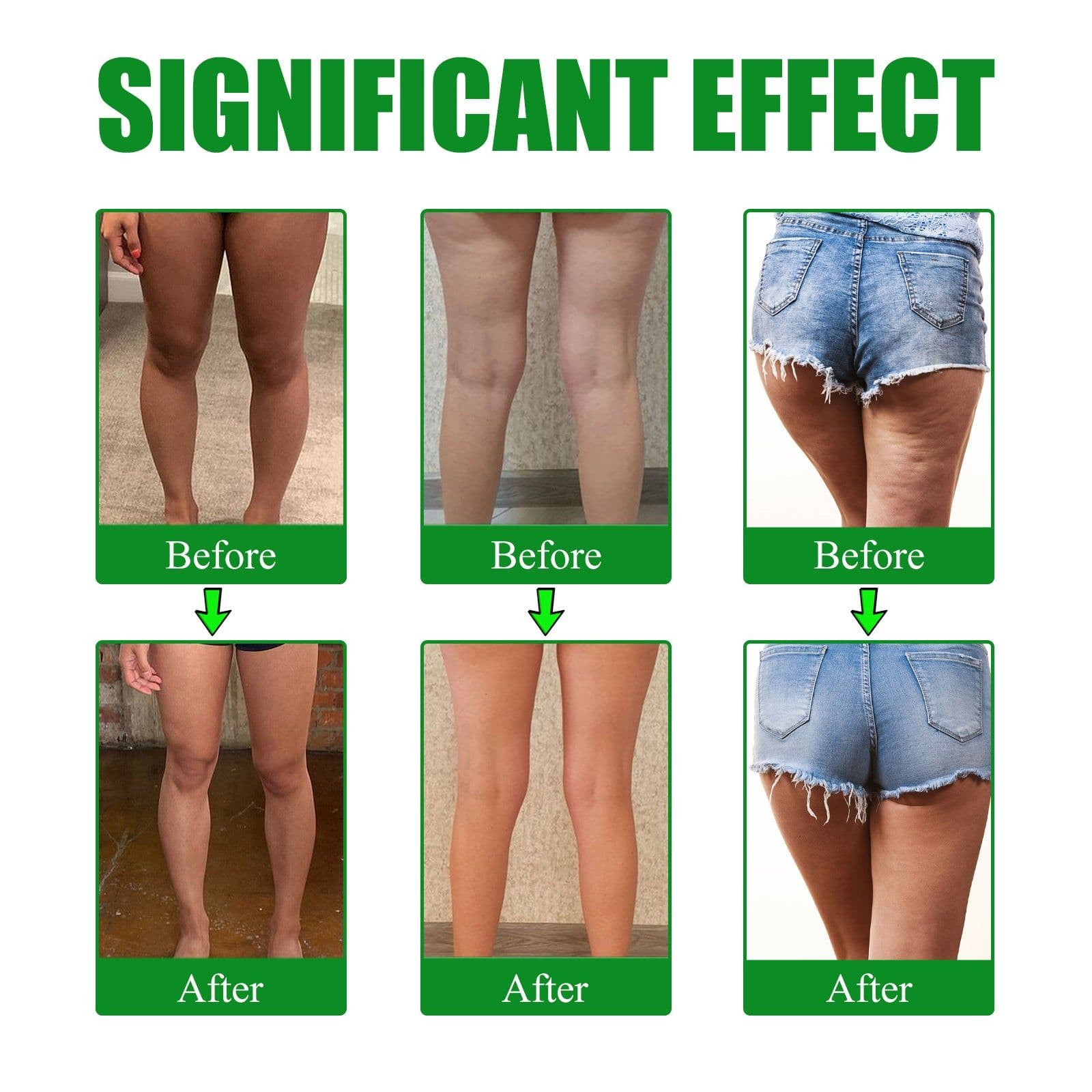 image-EELHOE Wormwood Leg Lifting Patch Anti-Cellulite