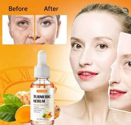 image-SEFUDUN Turmeric Essential Oil 30ml - Brightening