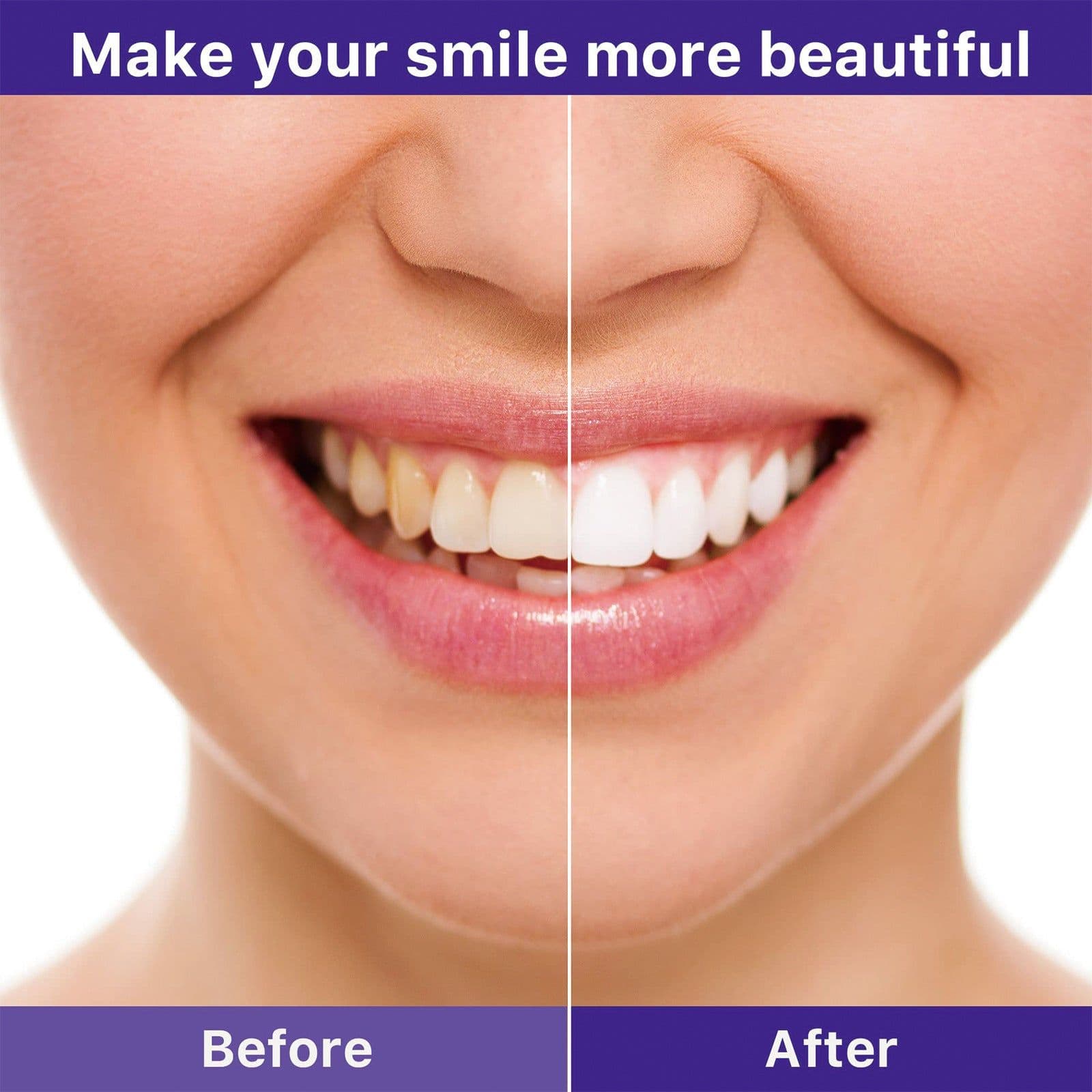 image-EELHOE V34 Teeth Whitening Toothpaste 30ml