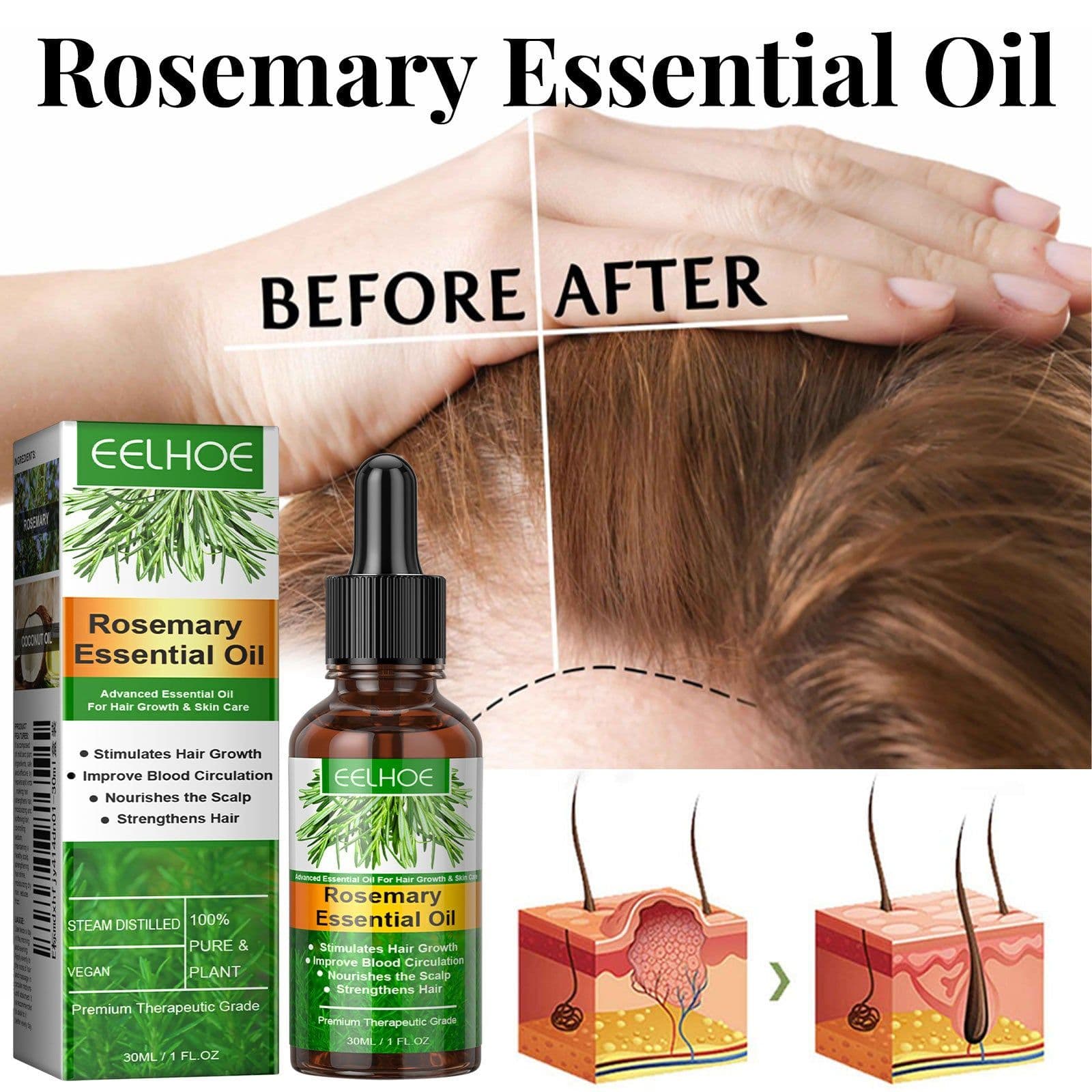 image-EELHOE Rosemary Hair Essential Oil 30ml