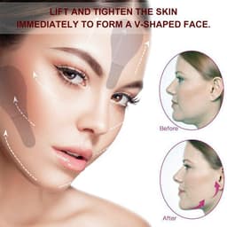 image-Milemei Face Lift Stickers V-Shaped - Set of 3
