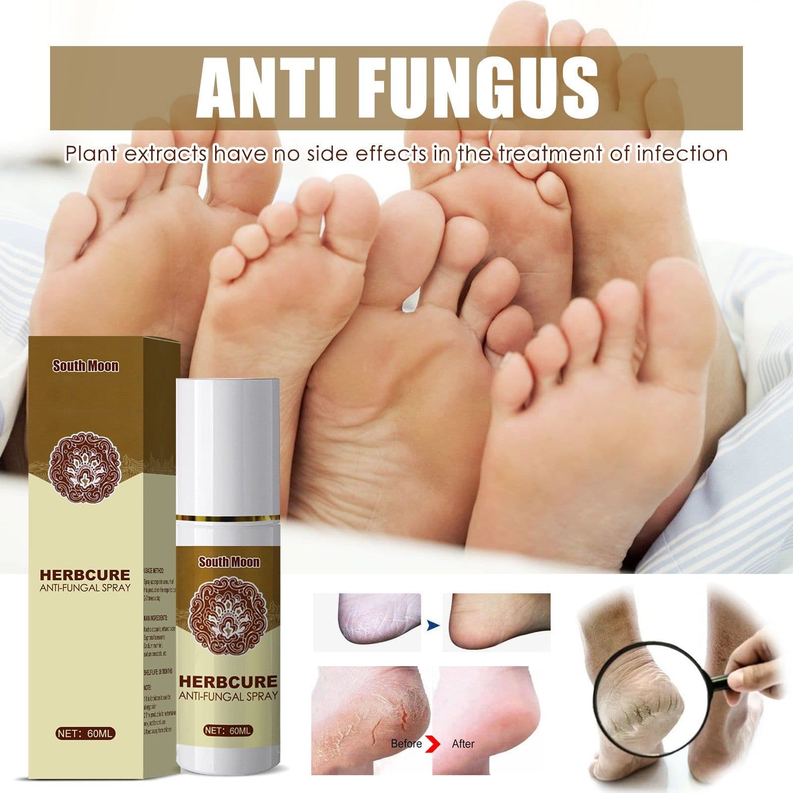 image-Herbal foot spray foot sweat foot odor care spray foot deodorant dehumidification spray plant anti-itch athlete's foot spray