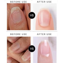image-Lian Biquan Nail Repair Pen 4ml Transparent