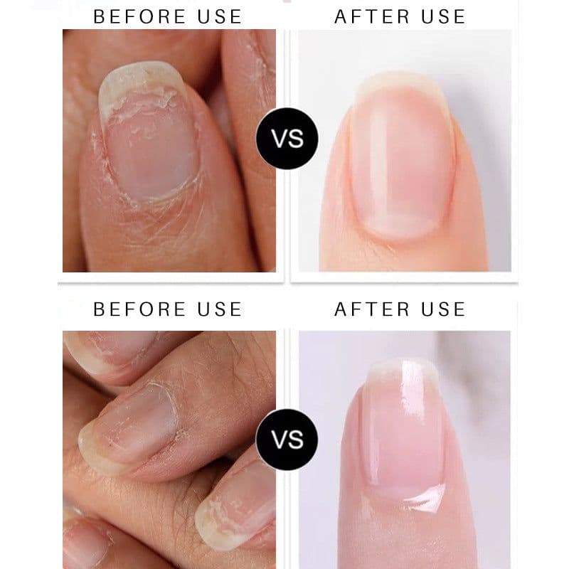image-Lian Biquan Nail Repair Pen 4ml Transparent
