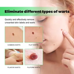 image-South Moon Anti-Wart Soap - Face & Body