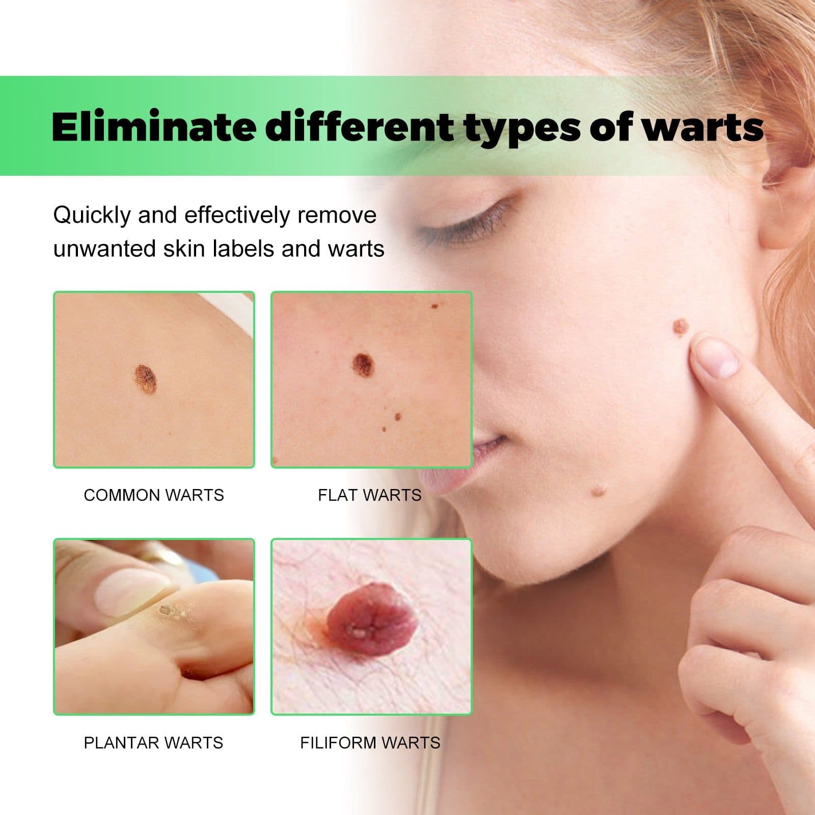 image-South Moon Anti-Wart Soap - Face & Body