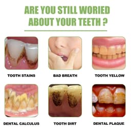 image-Teeth Whitening Essence - Stain Cleaning, Fresh Breath, Bright Teeth, 50ml